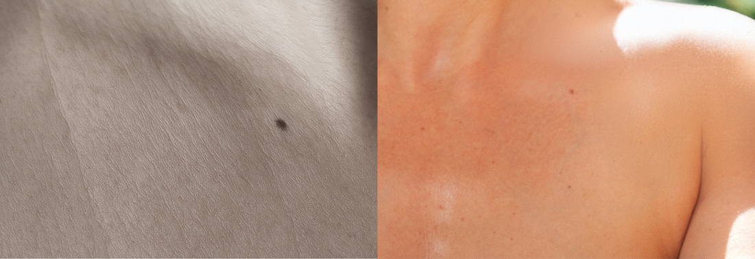 Why Dead Skin is aging you