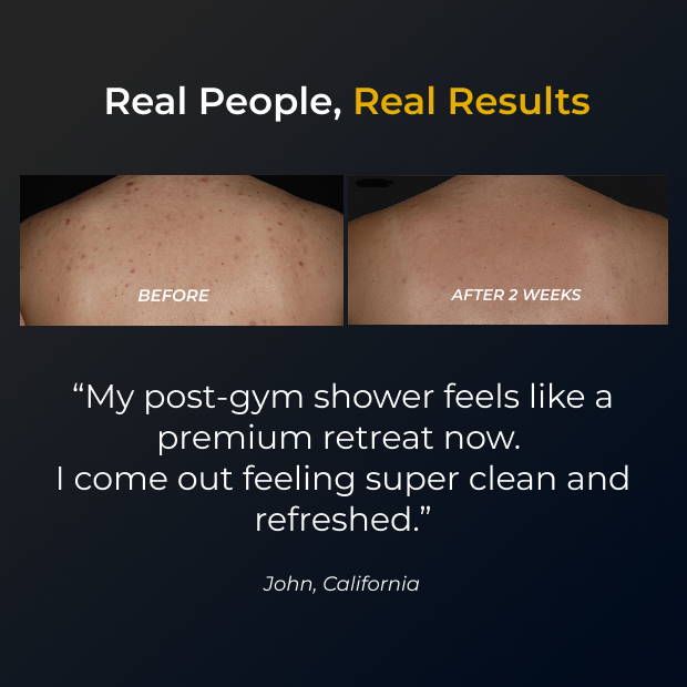 Sima® Japanese Exfoliating Shower Towel - backance