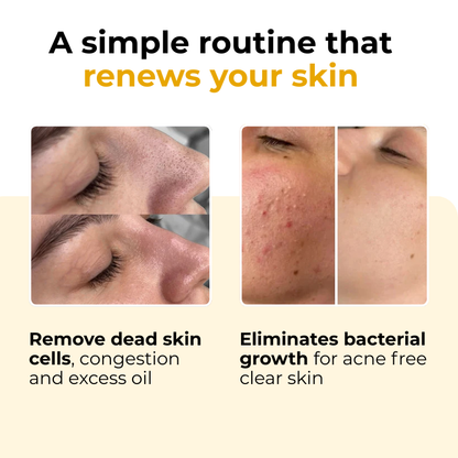 Discovery Kit – 2-Week Routine