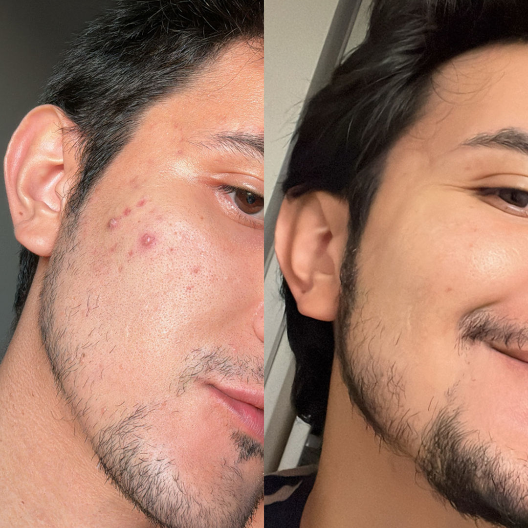 Beard & Face Freshness Kit