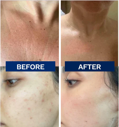Sima Core Skin Care Kit